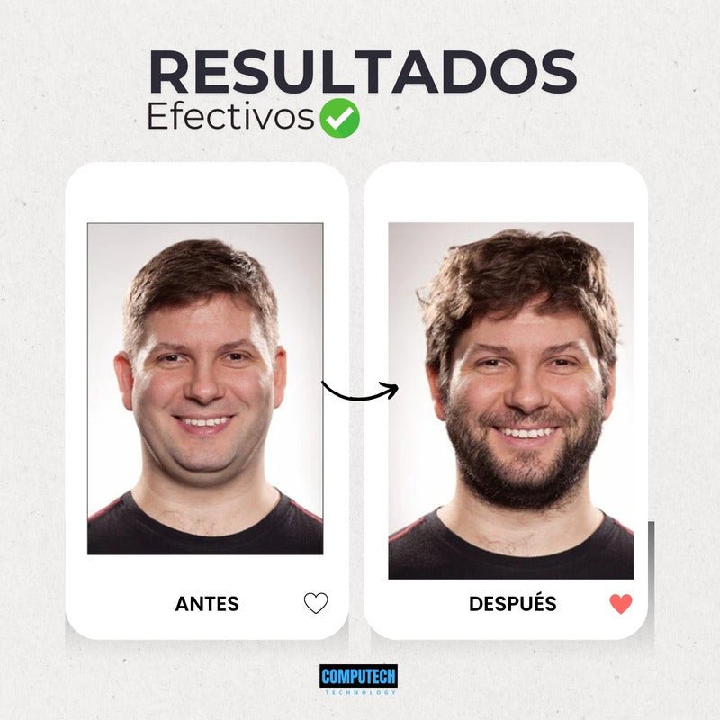 Kit Para El Crecimiento Y Cuidado De Barba Dermaroller - Mi tienda